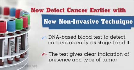 New Method to Detect Early Stage Cancers