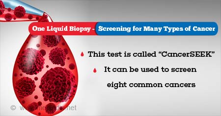 One Liquid Biopsy Screening for Cancers