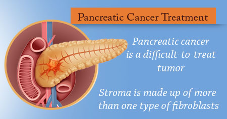 Treatment for Pancreatic Cancer