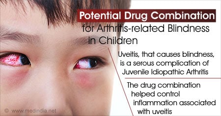 Novel Drug for Arthritis-related Blindness in Children