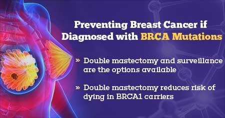 Reducing Risk of Death from Breast Cancer With Double Mastectomy