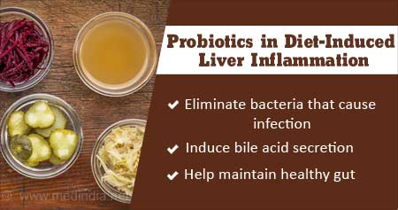 Probiotics to Kick Off Liver Inflammation Due To Fatty Diet