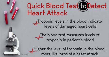Blood Test To Detect Heart Attack Risk
