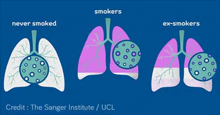 戒烟可降低患肺癌的风险