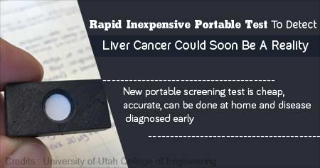 Detection of Liver Cancer Possible With Rapid Home Blood Test