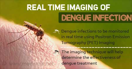 Health Tip Real Time Imaging of Dengue