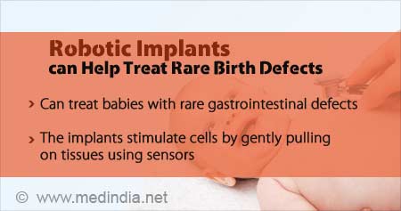 Robotic Implants to Treat Rare Birth Defects
