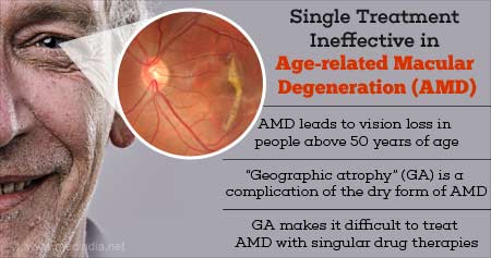 How Single treatment is Ineffective in Age-related Macular Degeneration (AMD)