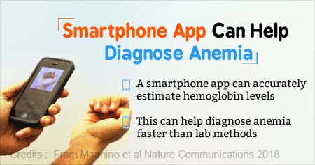 Smartphone App Capable of Accurately Diagnosing Anemia