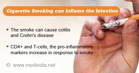吸烟会导致结肠炎、克罗恩病