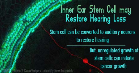 How Inner Ear Stem Cells may Restore Hearing Loss