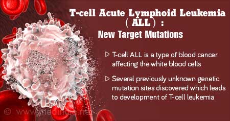 New T-cell Leukemia Target Mutations