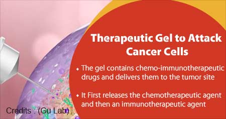 New Injectable Gel Therapy To Fight Cancer Cells