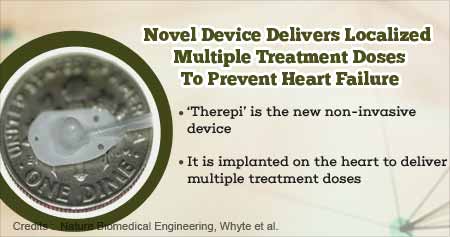 New Device Implanted on Heart Prevents Heart Failure