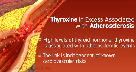 High Levels of Thyroid Hormone Associated With Artery Disease and Death