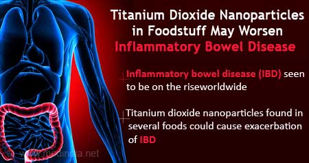 How Titanium Dioxide In Foods can Worsen Inflammatory Bowel Disease (IBD)