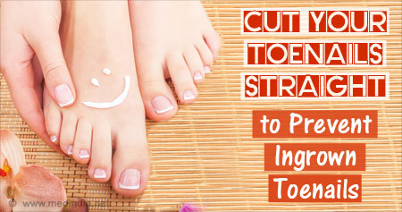 Useful health Tip to Prevent Ingrown Toenails
