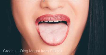 Tongue Microbiome Could Help Early Detection of Pancreatic Cancer