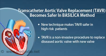 New Technique Reduces Risk of Coronary Obstruction During Heart Valve Replacement