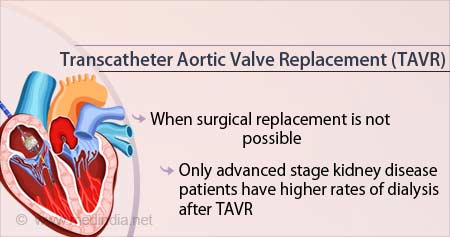 Risk of Dialysis in Kidney Patients After Transcatheter Aortic Valve Replacement