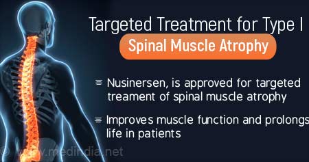 Targeted Treatment for Type 1 Spinal Muscle Atrophy