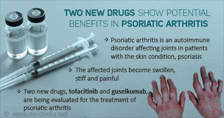 New Drugs for Psoriatic Arthritis
