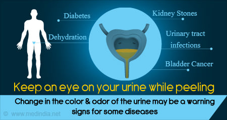 Color and Odor of Urine