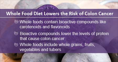 Whole Foods to Lower Risk of Colon Cancer