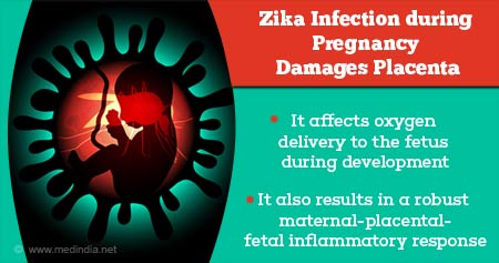How Zika Infection During Pregnancy can Damage Placenta
