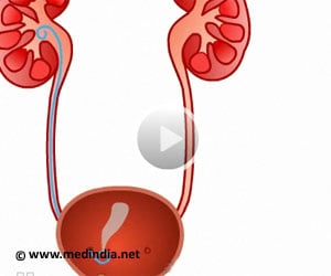 Infected Diabetic Kidney-Draining Pus through Stent 