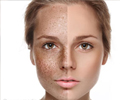Home Remedies for Skin Pigmentation