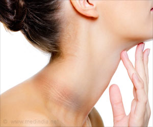 Top 10 Home Remedies to Get Rid of Dark Neck