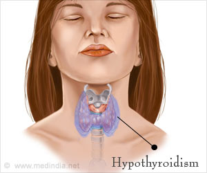 Top 10 Home Remedies to Treat Hypothyroidism