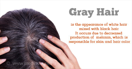 Premature Greying Of Hair White Hair  Treatment Symptoms  Risk Factors