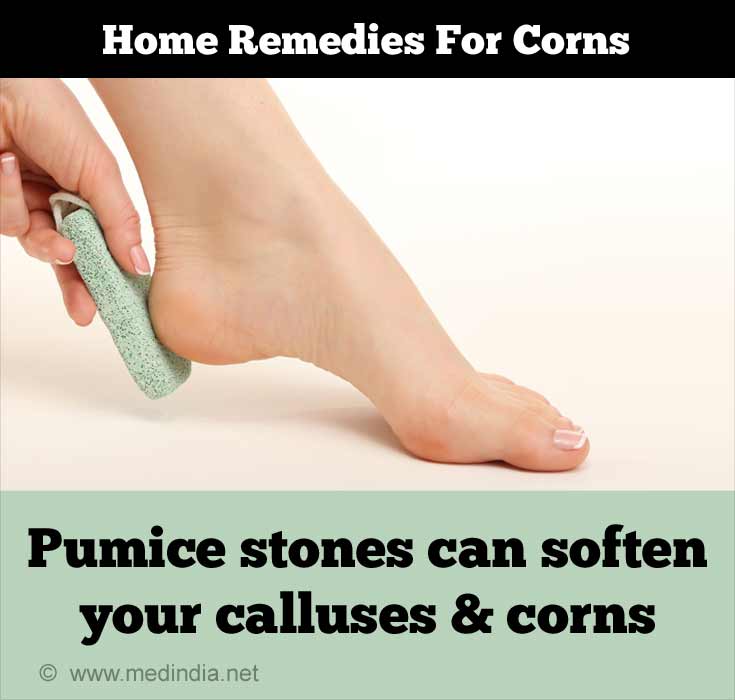 https://images.medindia.net/homeremedies/950_400/corns-pumice-stones.jpg