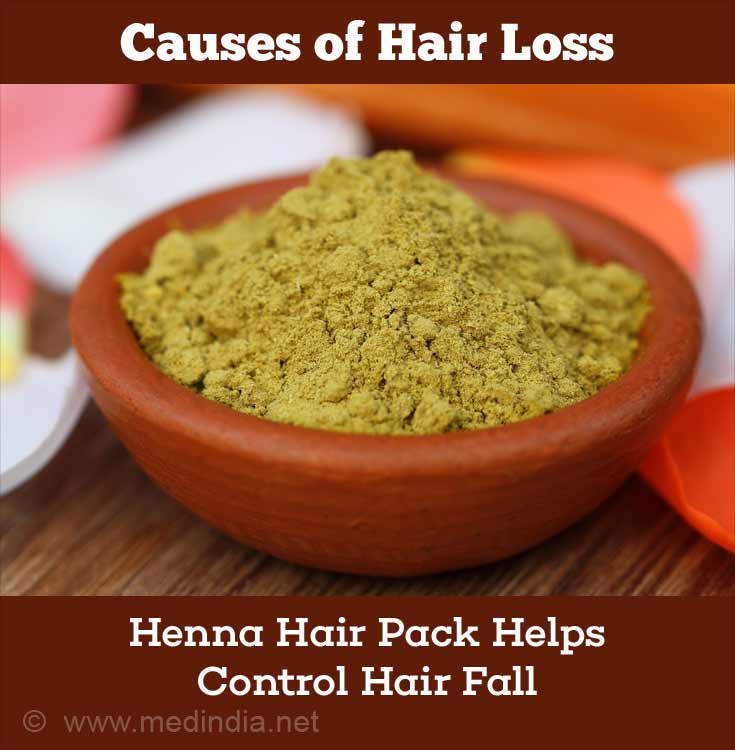 Henna Prevents Hair Fall Henna Prevents Hair Fall