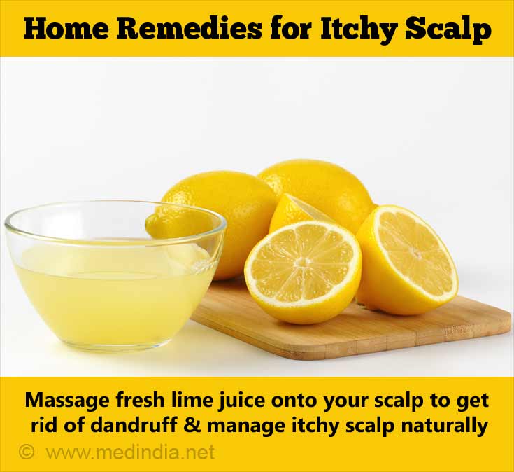 Lime Juice for Itchy Scalp Lime Juice for Itchy Scalp