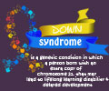 Infographics on Down Syndrome