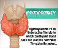 Infographics on Hypothyroidism