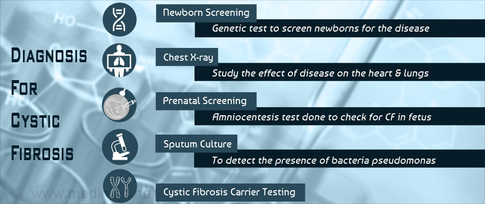 Diagnosis of Cystic Fibrosis Diagnosis of Cystic Fibrosis