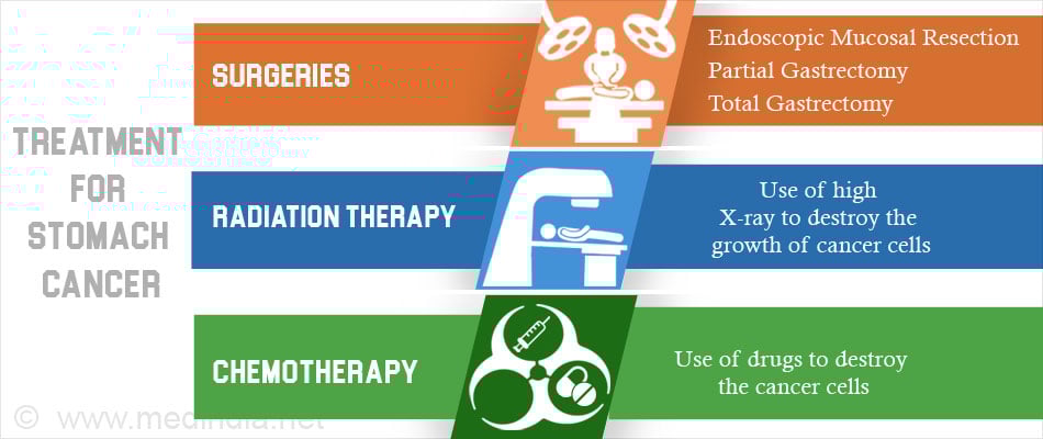 Treatment for Gastric Cancer Treatment for Gastric Cancer