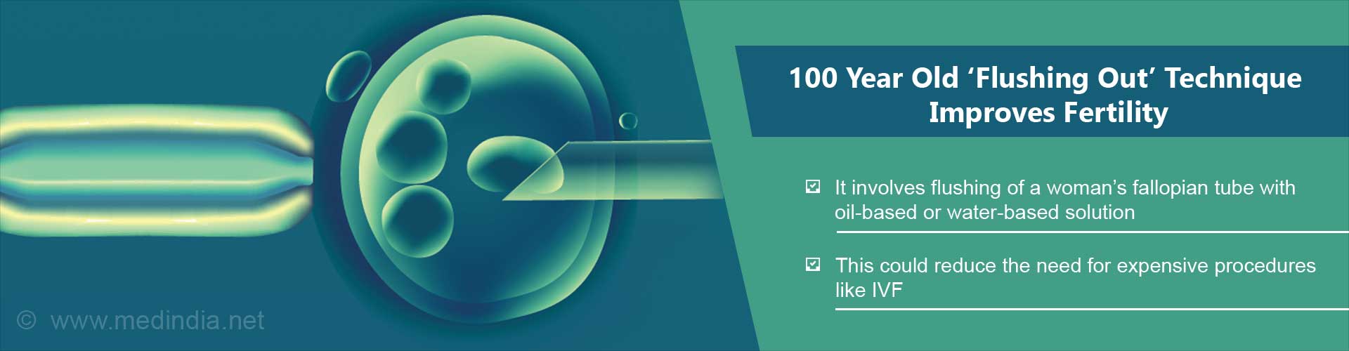 100 Year Old 'Flushing Out' Technique Boosts Fertility, Helps Infertile Couples