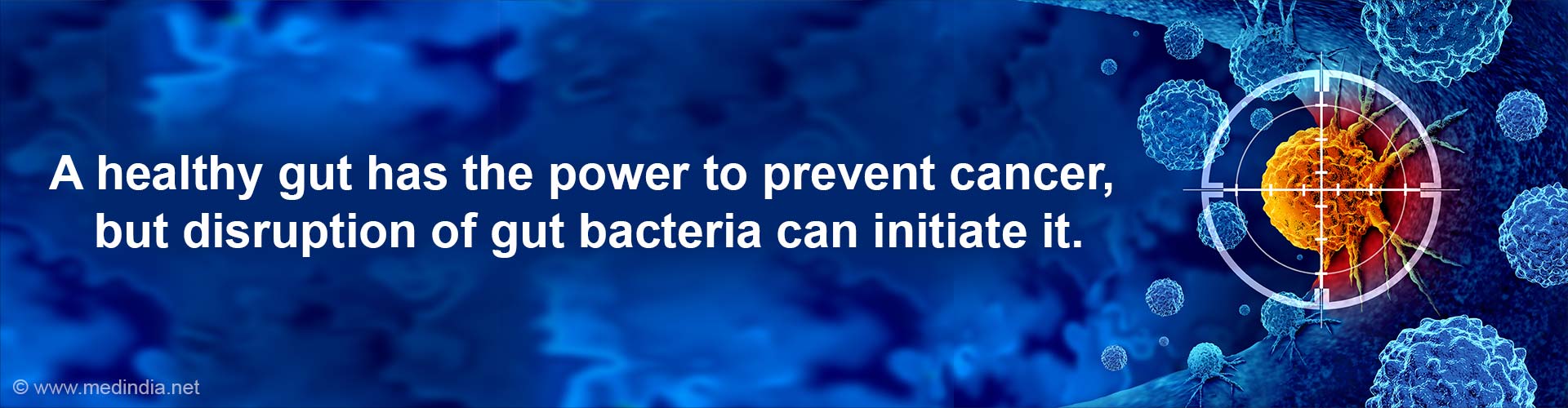 Decoding the Role of Gut Bacteria in Cancer