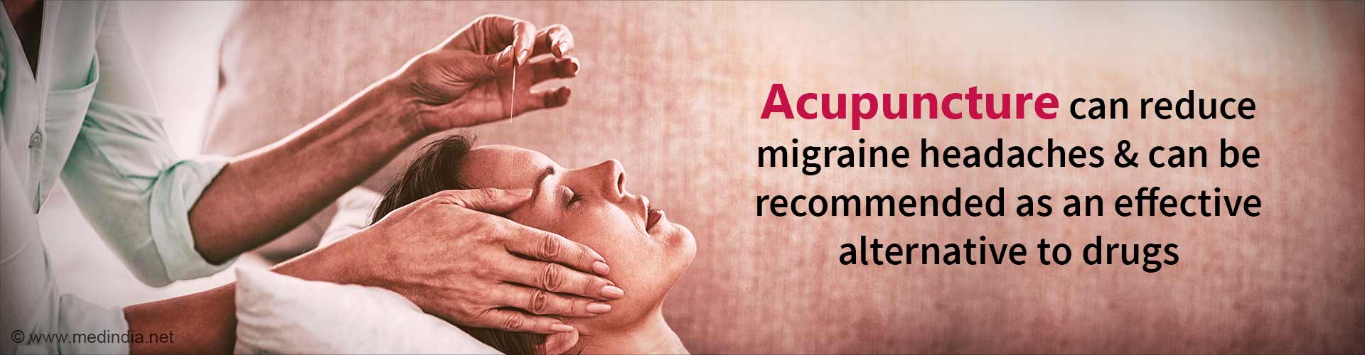 Acupuncture can Treat Migraines