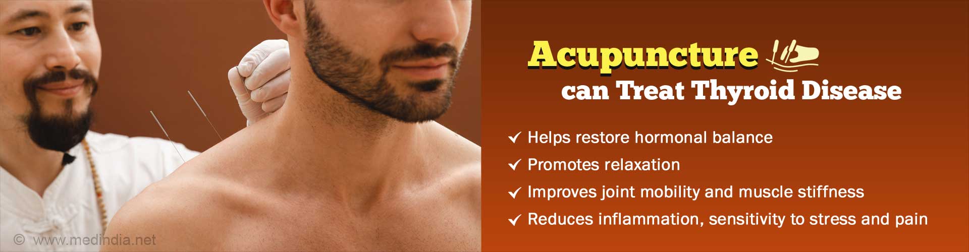 Can Acupuncture Treat Thyroid Disease?