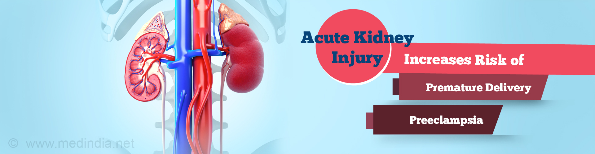 Pregnancy Complications Linked to History of Acute Kidney Injury