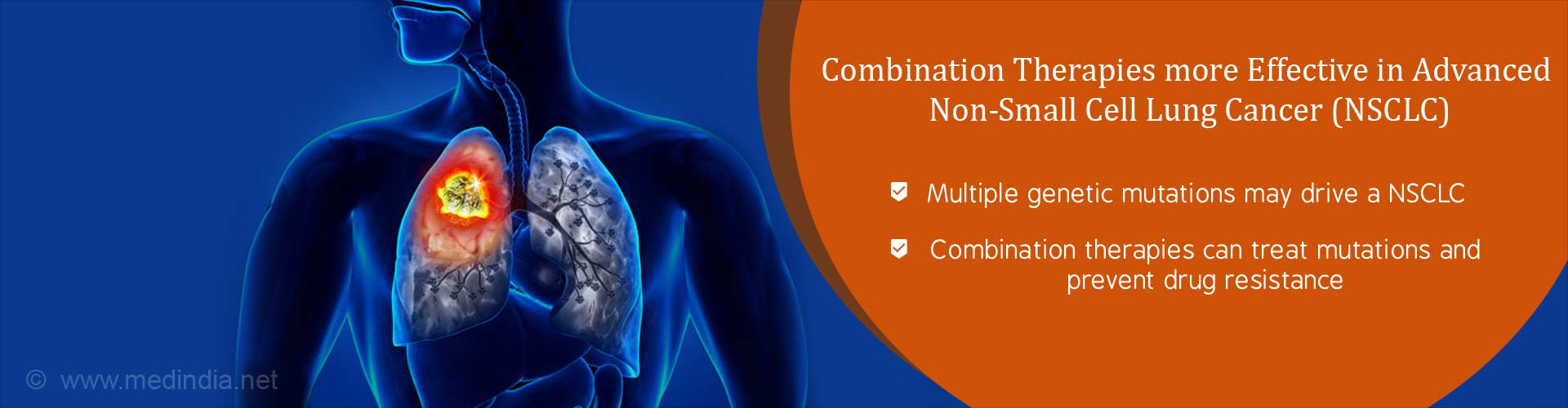 Combination Targeted Therapies may Improve Outcomes in Advanced Non-Small Cell Lung Cancer (NSCLC)