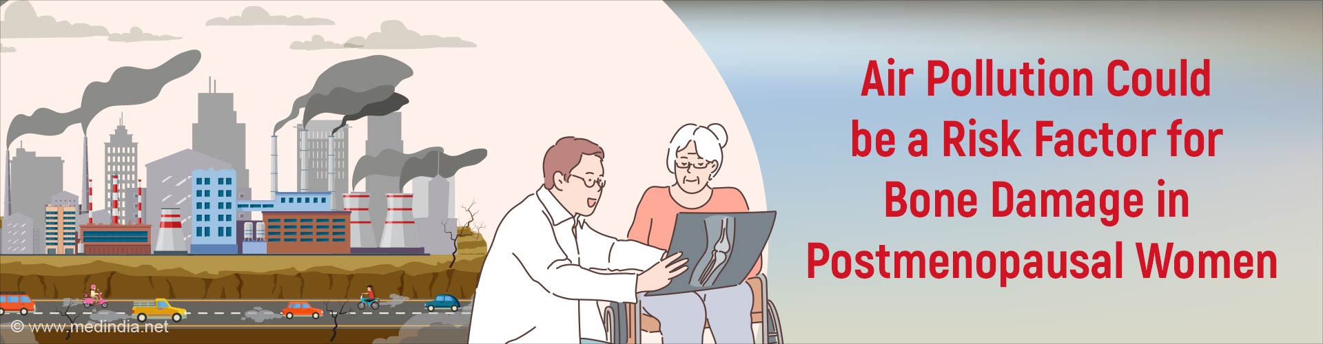 Air Pollution can Double the Risk of Bone Damage