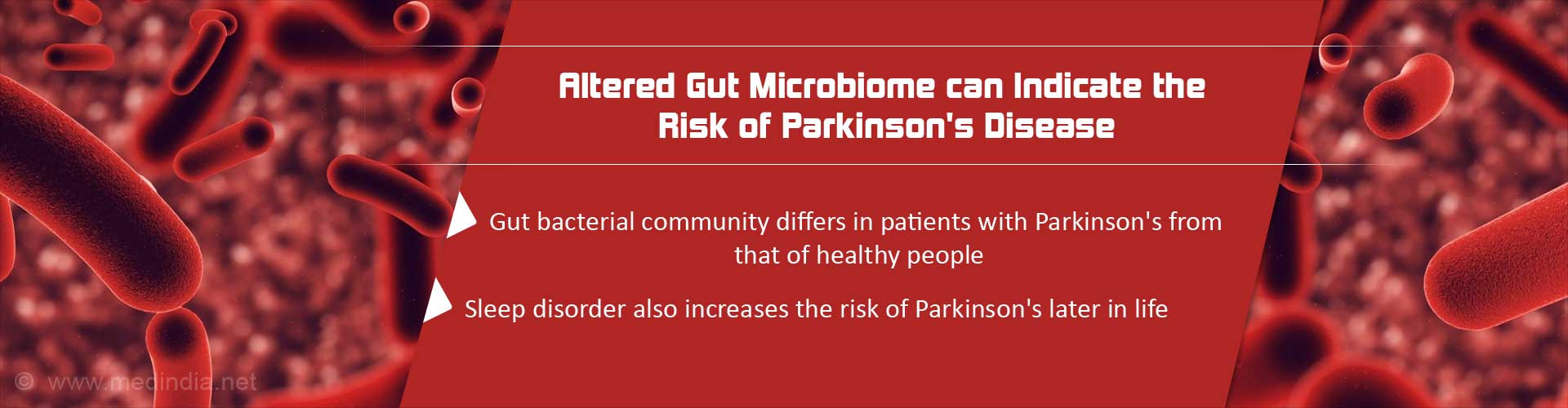 Altered Gut Microbiome Can Be an Indicator of Parkinson's Disease Altered Gut Microbiome Can Be an Indicator of Parkinson's Disease