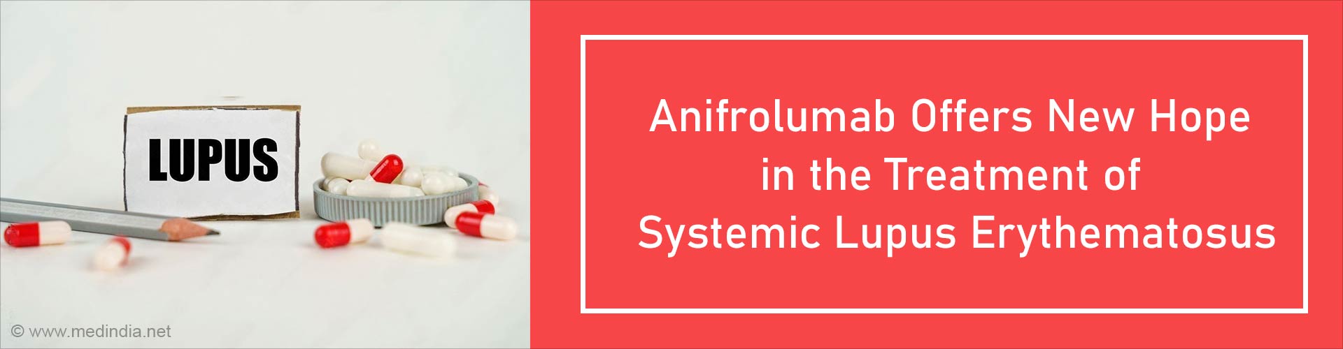 Lupus can be Managed With Anifrolumab